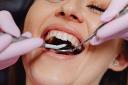 Achieve a Brighter, More Confident Smile with Teeth Whitening and Composite Bonding at Iconic Smiles
