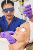 Post-Treatment Care Tips for Fractional Laser Patients in Riyadh