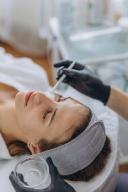 The Different Types of Chemical Peels Available in Riyadh