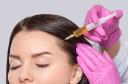 Rejuvenate Your Hair with PRP in Riyadh