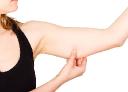 Arm Lift Surgery for Addressing Changes After Weight Loss