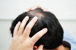How PRP Hair Treatment Complements Modern Hair Restoration Approaches