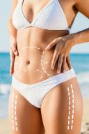 Liposuction for Defining Your Shape Beyond Weight Loss