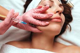 Understanding Facial Changes After Thread Lift Treatment