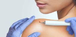 Skin Tag Removal: Understanding the Importance of Assessment