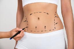 How Body Contouring With Liposuction Can Change Your Silhouette