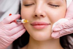 Can Radiesse Filler Define the Jawline?