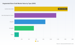   PW Consulting: Augmented Bone Graft Market to Hit $6,295.06M by 2032, Expanding at 6.18% CAGR