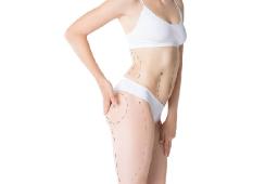 What Determines Candidacy for Liposuction in Riyadh?