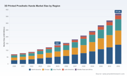 3D Printed Prosthetic Hands Market: Why 15.12% CAGR Drives $372M Growth by 2032