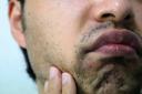 Are Smoker&rsquo;s Lips Treatments Safe?
