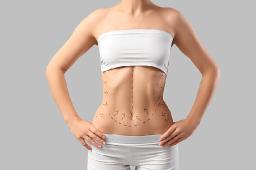 How Doctors Personalize Liposuction for Different Body Areas