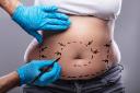How Fat Melting Injections in Riyadh Support Body Contouring