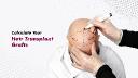 Hair Transplant Clinic in Gurgaon: Complete Guide to Choosing the Right Clinic