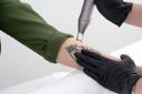 Aftercare Tips for Laser Tattoo Removal in Riyadh