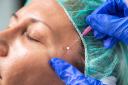 Riyadh&rsquo;s Best Surgeons for Natural-Looking Thread Lift Results