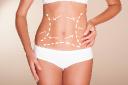 Can a Tummy Tuck Remove Loose Skin After Weight Loss?