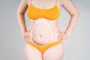 Abdominoplasty and Tummy Tuck: Important Recovery Tips