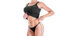 Lifestyle Tips for Maintaining Liposuction Results in Riyadh