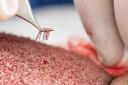 Understanding the Science Behind Stem Cell Therapy