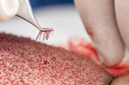 Understanding the Science Behind Stem Cell Therapy