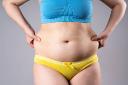 What Abdominal Concerns Can Tummy Tuck Surgery Help Address?