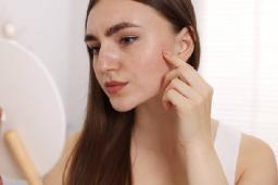 Pigmentation Treatment Insights for Treating Uneven Tone Across the Face