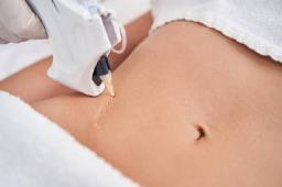 Laser Scar Removal for Smoother-Looking and Refined Skin
