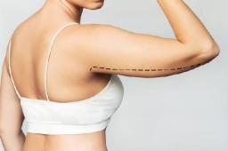Liposuction in Riyadh: Understanding Recovery and Expected Outcomes