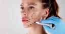 Tips for Managing Swelling and Bruising After a Facelift
