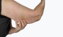 Arm Lift Surgery Options: A Complete Overview