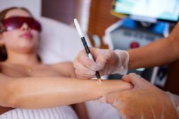 Does Mole Removal Hurt? Understanding the Procedure and Recovery