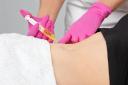 How to Prepare for Fat-Dissolving Injections