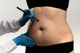 Is Fat Transfer Surgery Right for You?