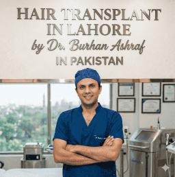 Hair Transplant in Lahore: Complete Cost Breakdown & Before After Results