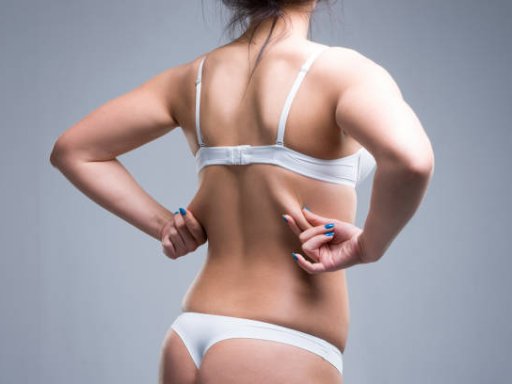 Liposuction