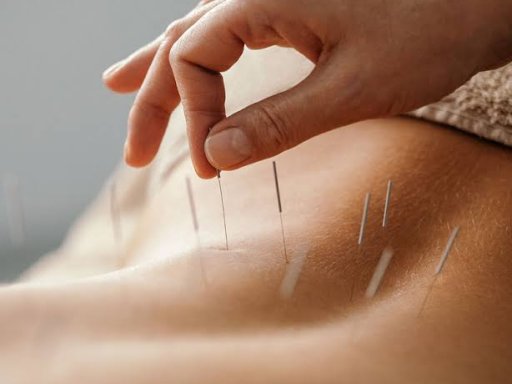 Grandmadisonacupuncture