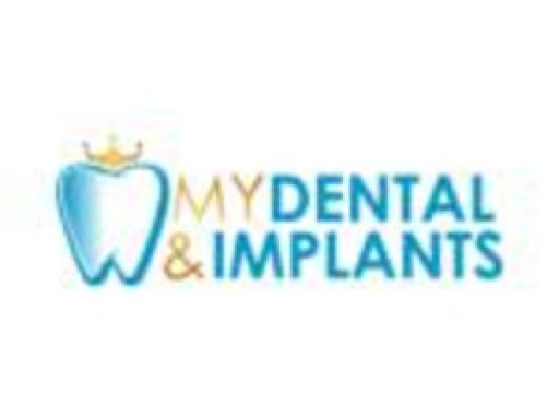 mydentalmplants